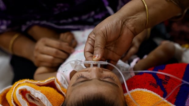 “Measles Outbreak Sparks Crisis in Bangladesh”