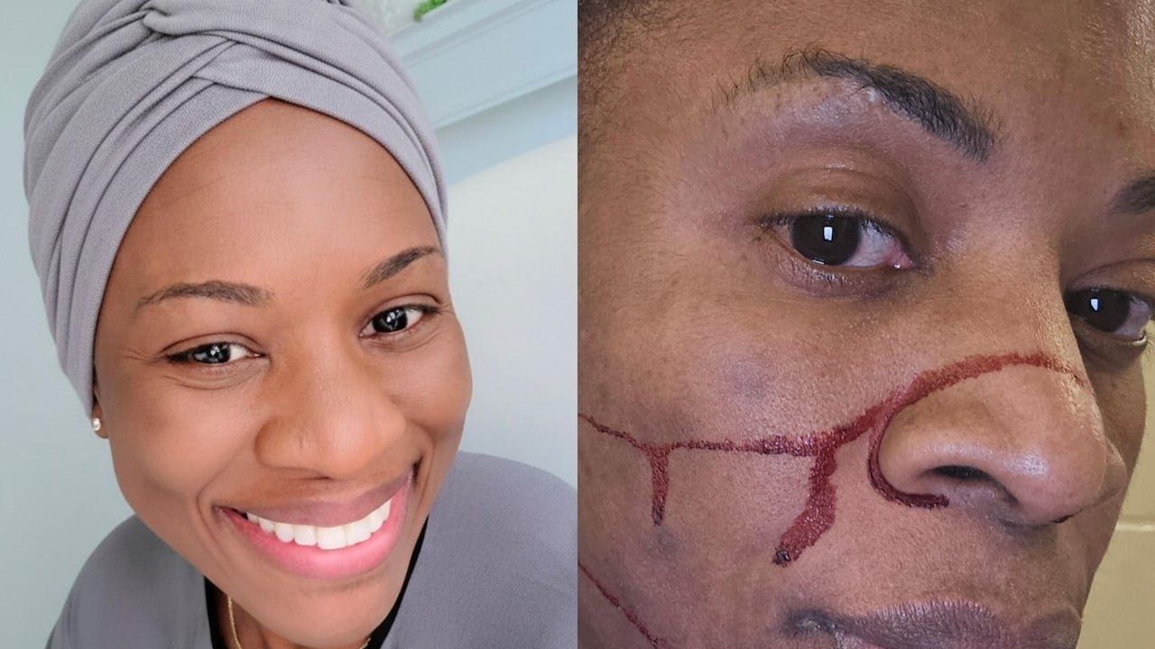 default-355 Lawyer Sudine Riley describes an incident involving multiple Durham Regional police officers forcefully slamming her head on a desk and escorting her to the basement cells at the Oshawa courthouse. An image showing an injury she sustained during the incident is displayed on the right side.