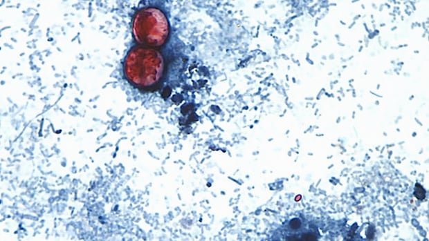 “FDA Links Taylor Farms Lettuce to Cyclosporiasis Outbreak”
